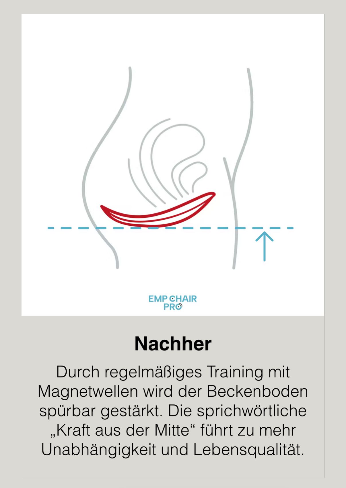 Nachher - Gestärkter Beckenboden
