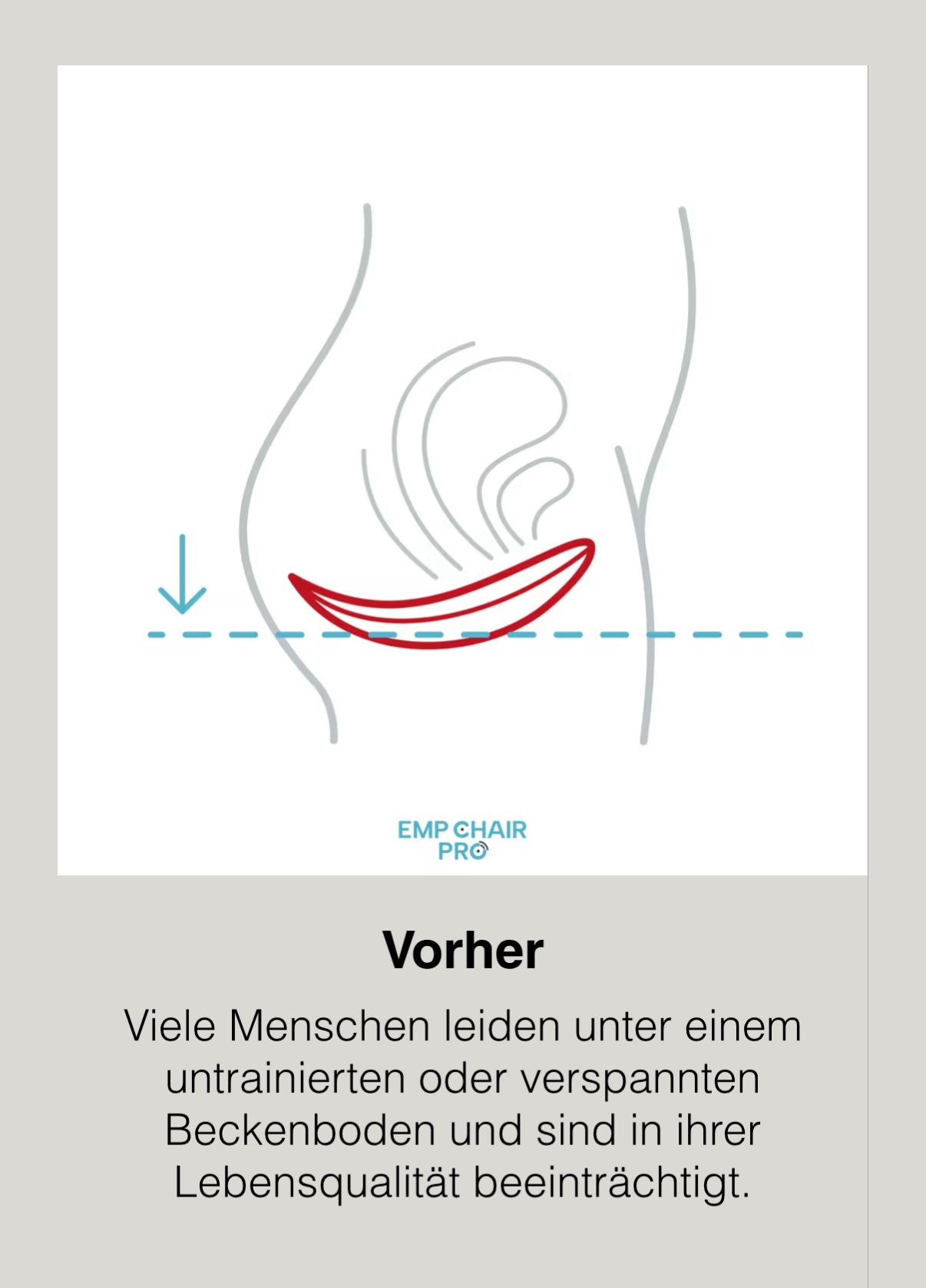Vorher - Schwacher Beckenboden